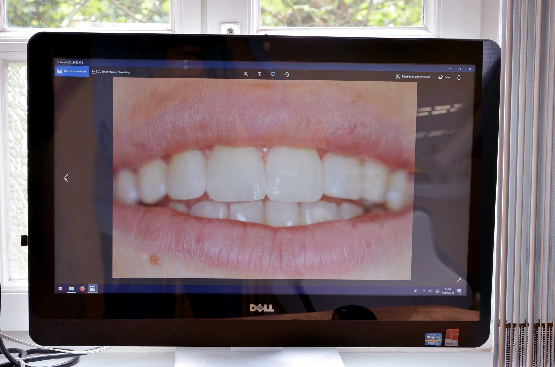 Ein Computer im Behandlungszimmer zeigt den Befund an